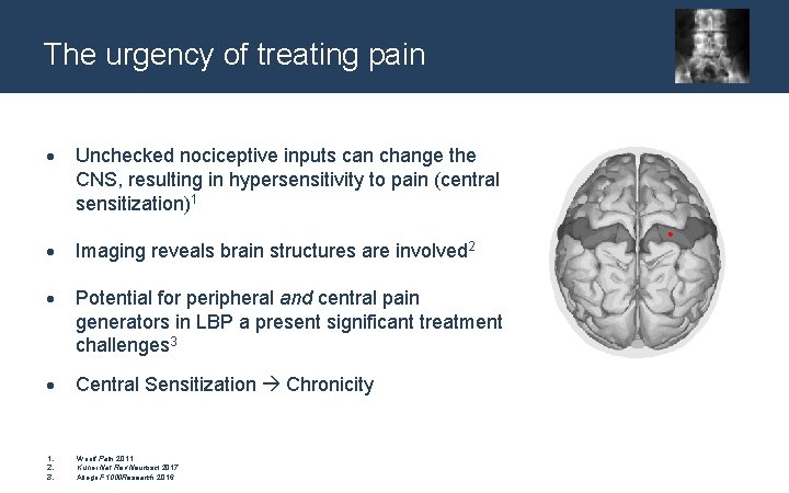 The urgency of treating pain Unchecked nociceptive inputs can change the CNS, resulting in