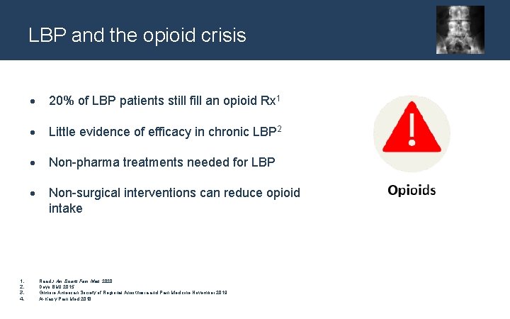 LBP and the opioid crisis 1. 2. 3. 4. 20% of LBP patients still