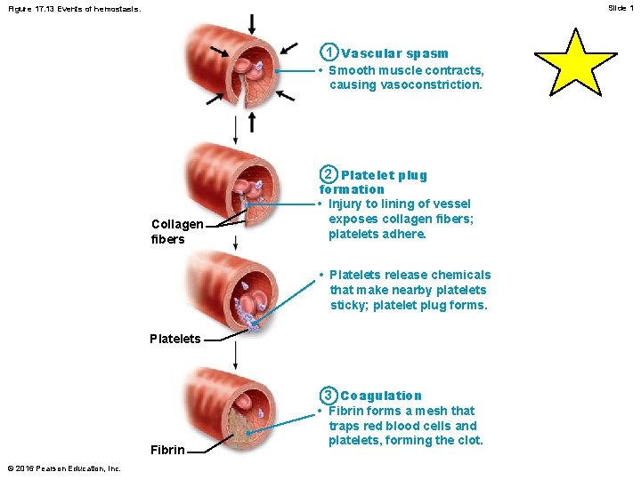 Slide 1 Figure 17. 13 Events of hemostasis. 1 Vascular spasm • Smooth muscle