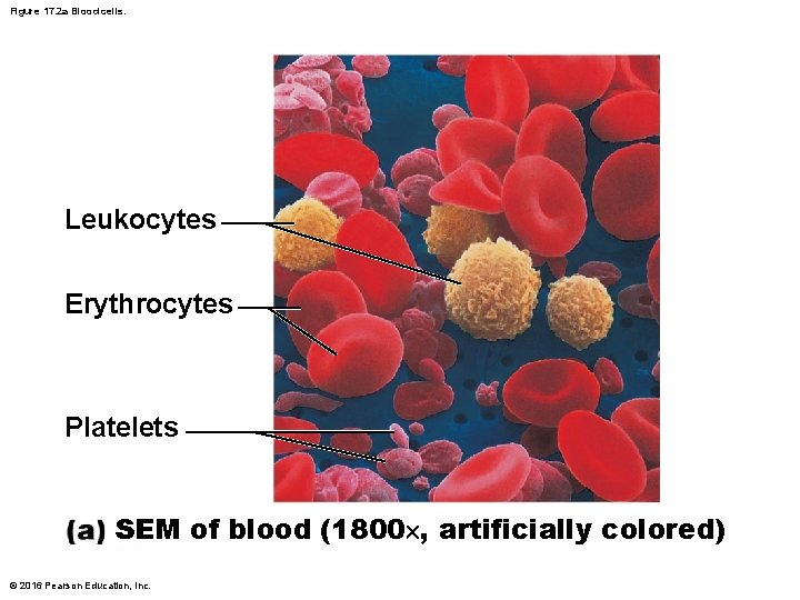 Figure 17. 2 a Blood cells. Leukocytes Erythrocytes Platelets SEM of blood (1800 ,