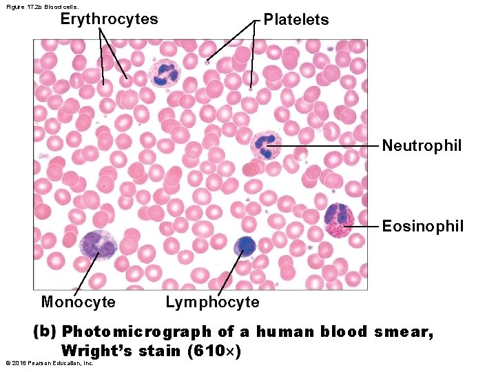 Figure 17. 2 b Blood cells. Erythrocytes Platelets Neutrophil Eosinophil Monocyte Lymphocyte Photomicrograph of