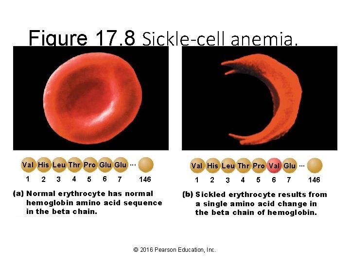 Figure 17. 8 Sickle-cell anemia. Val His Leu Thr Pro Glu. . . 1