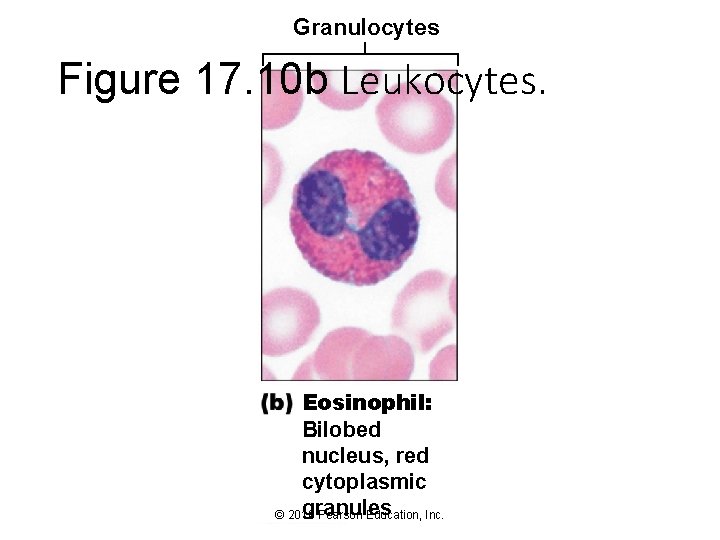 Granulocytes Figure 17. 10 b Leukocytes. Eosinophil: Bilobed nucleus, red cytoplasmic granules © 2016