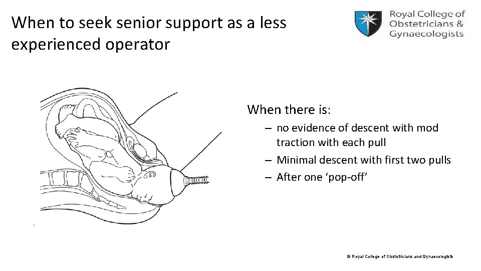 When to seek senior support as a less experienced operator When there is: –