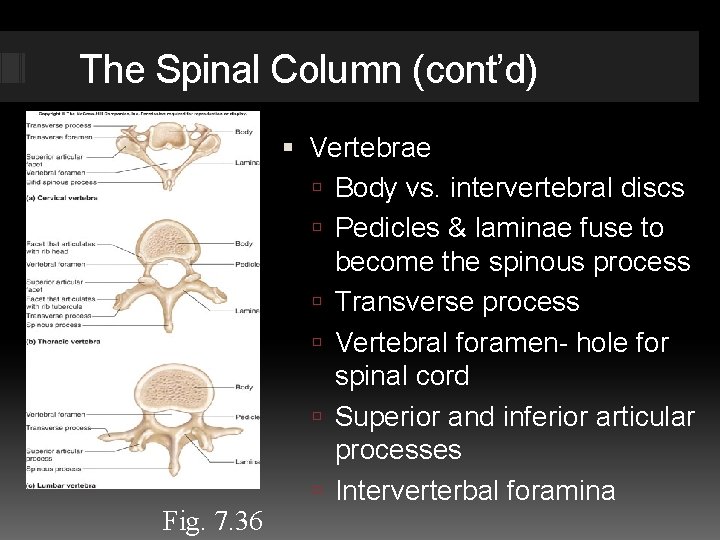 The Spinal Column (cont’d) Fig. 7. 36 Vertebrae Body vs. intervertebral discs Pedicles &