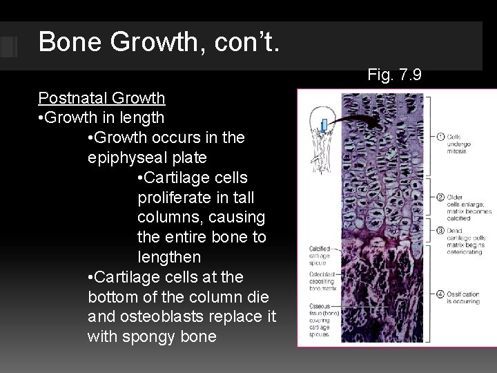 Bone Growth, con’t. Fig. 7. 9 Postnatal Growth • Growth in length • Growth