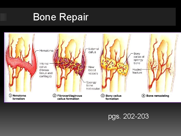 Bone Repair pgs. 202 -203 