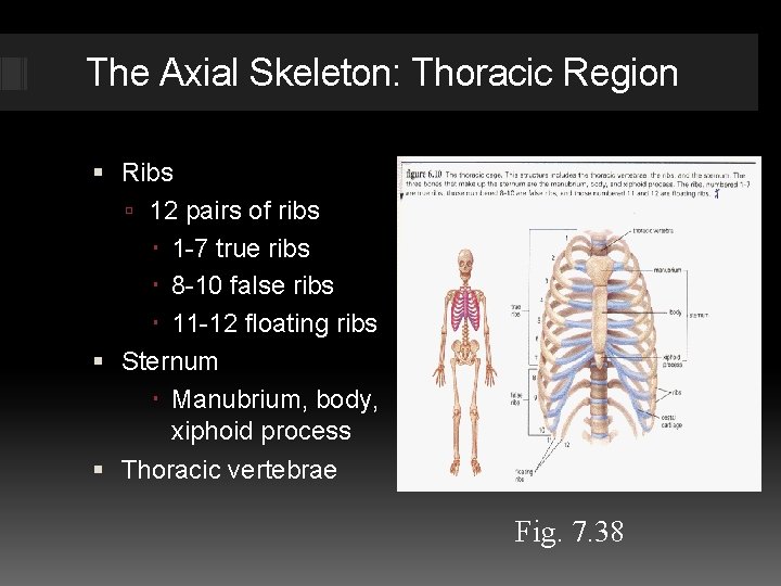 The Axial Skeleton: Thoracic Region Ribs 12 pairs of ribs 1 -7 true ribs