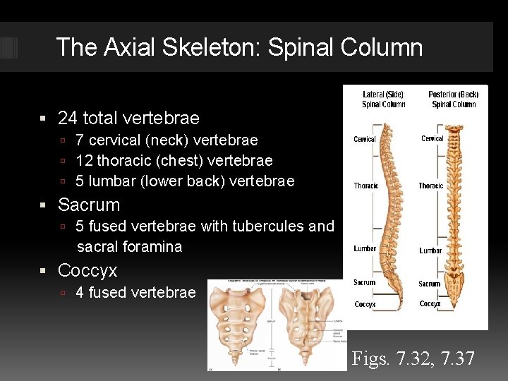 The Axial Skeleton: Spinal Column 24 total vertebrae Fig. 7. 16 7 cervical (neck)