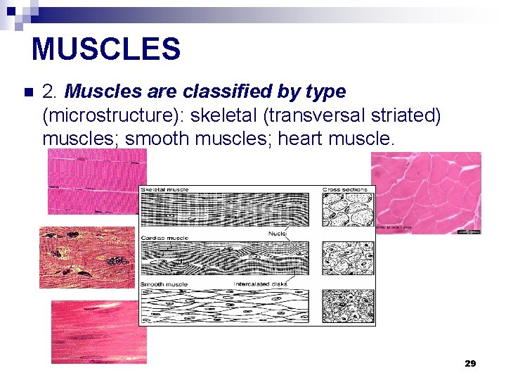 MUSCLES n 2. Muscles are classified by type (microstructure): skeletal (transversal striated) muscles; smooth