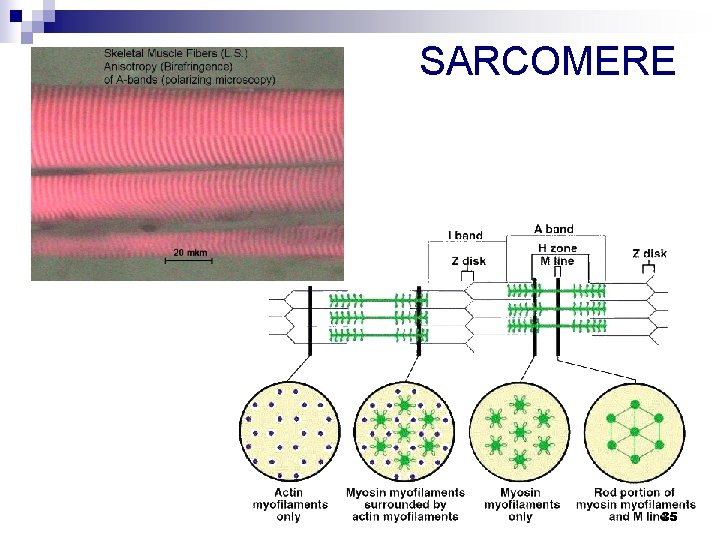 SARCOMERE 35 