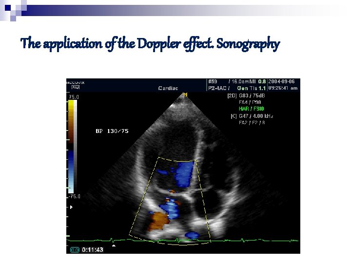 The application of the Doppler effect. Sonography 