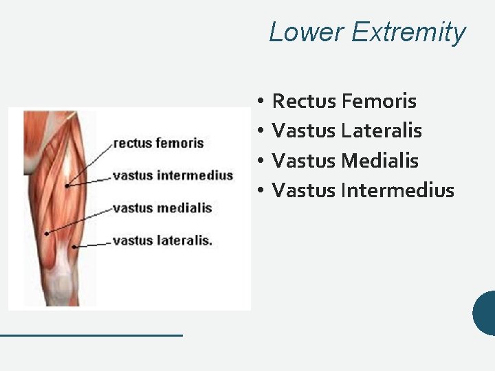 Lower Extremity • • Rectus Femoris Vastus Lateralis Vastus Medialis Vastus Intermedius Lower Extremity • • Rectus Femoris Vastus Lateralis Vastus Medialis Vastus Intermedius