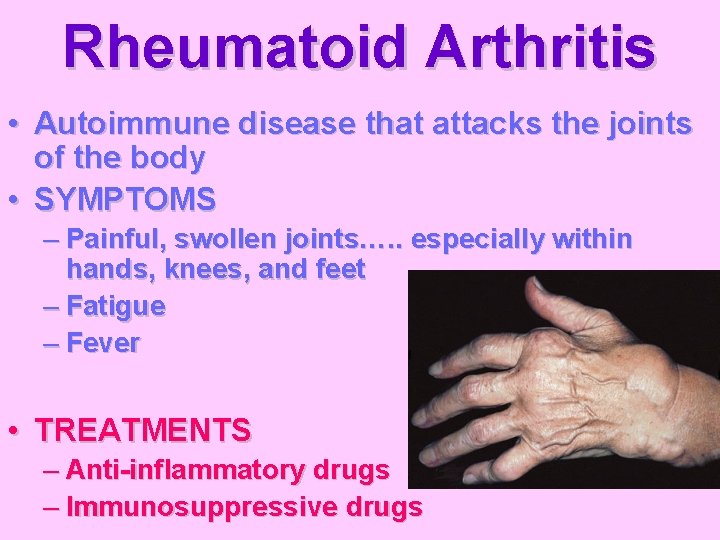 Rheumatoid Arthritis • Autoimmune disease that attacks the joints of the body • SYMPTOMS