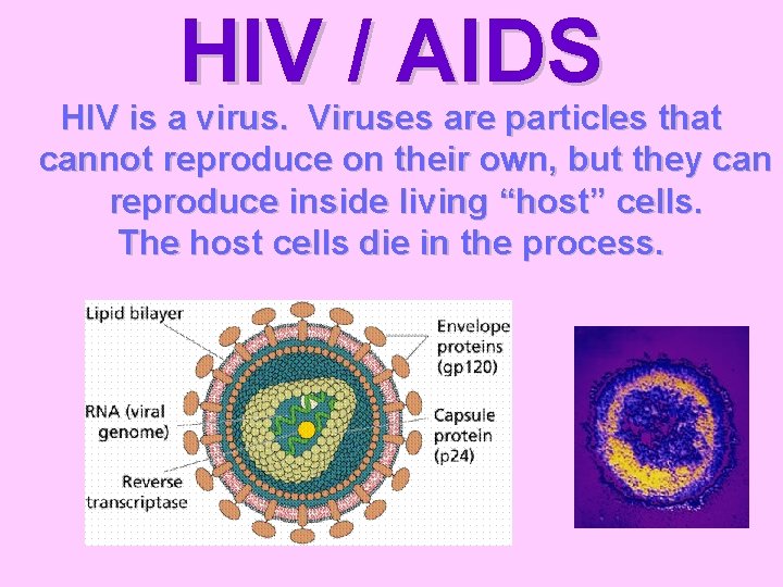 HIV / AIDS HIV is a virus. Viruses are particles that cannot reproduce on