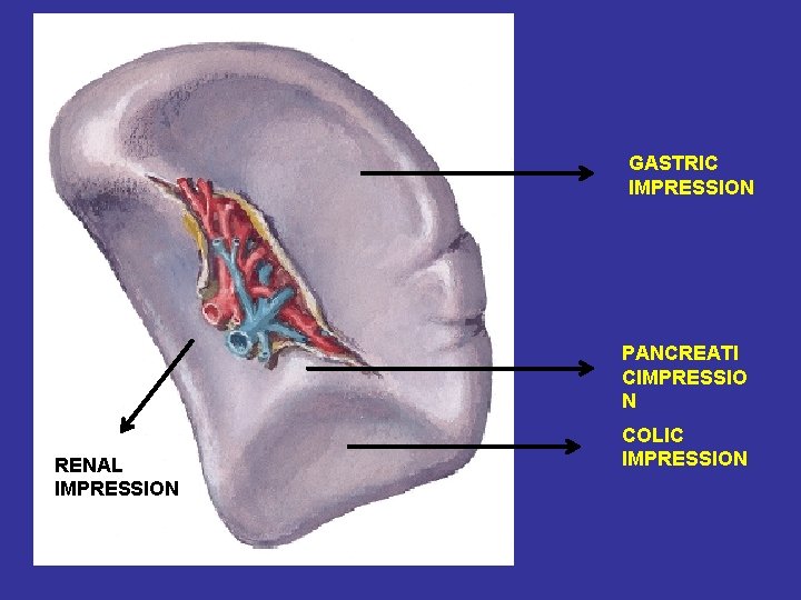 GASTRIC IMPRESSION PANCREATI CIMPRESSIO N RENAL IMPRESSION COLIC IMPRESSION 