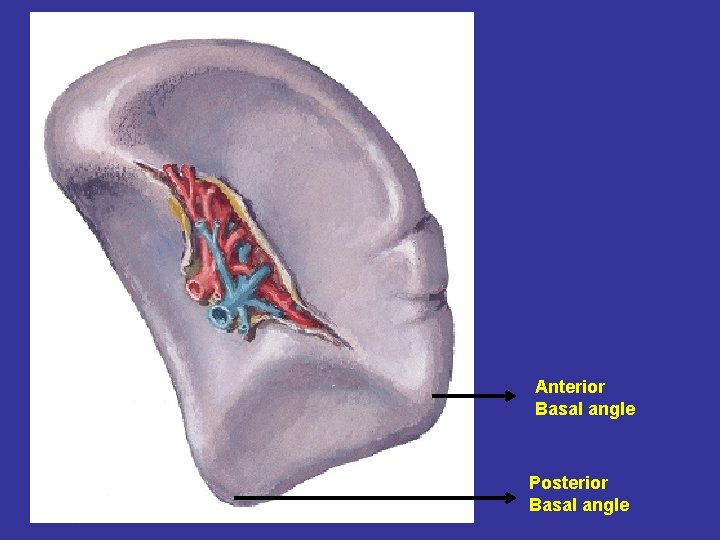 Anterior Basal angle Posterior Basal angle 