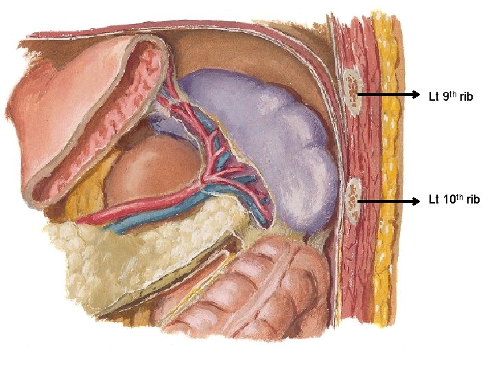 Lt 9 th rib Lt 10 th rib 