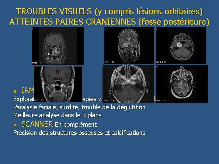 TROUBLES VISUELS (y compris lésions orbitaires) ATTEINTES PAIRES CRANIENNES (fosse postérieure) n IRM+++ (sauf