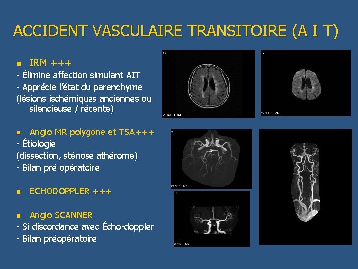 ACCIDENT VASCULAIRE TRANSITOIRE (A I T) n IRM +++ - Élimine affection simulant AIT