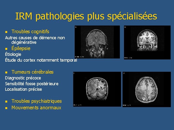 IRM pathologies plus spécialisées n Troubles cognitifs Autres causes de démence non dégénérative n