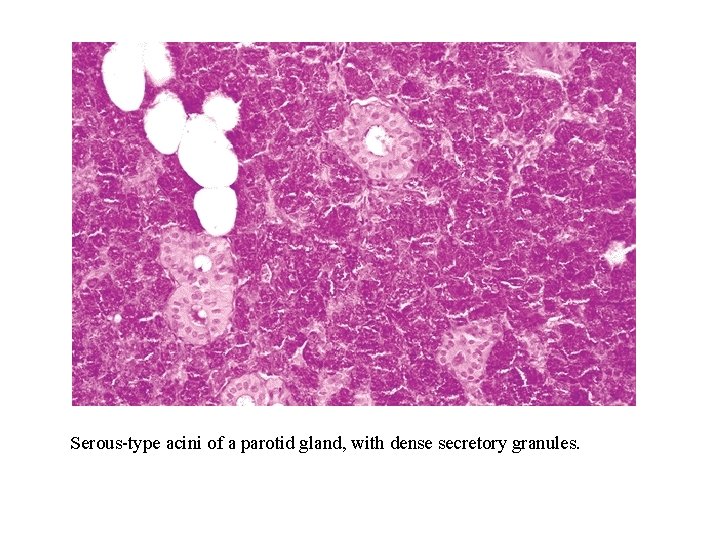 Serous-type acini of a parotid gland, with dense secretory granules. 