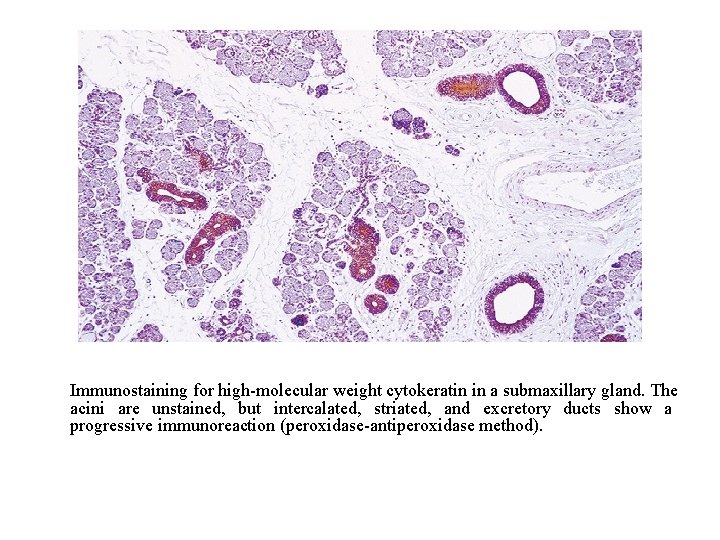 Immunostaining for high-molecular weight cytokeratin in a submaxillary gland. The acini are unstained, but