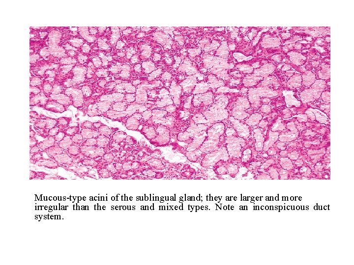 Mucous-type acini of the sublingual gland; they are larger and more irregular than the