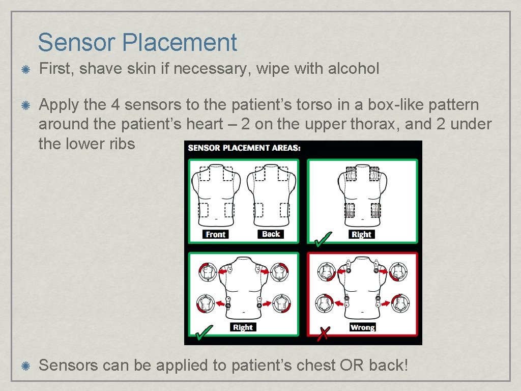 Sensor Placement First, shave skin if necessary, wipe with alcohol Apply the 4 sensors