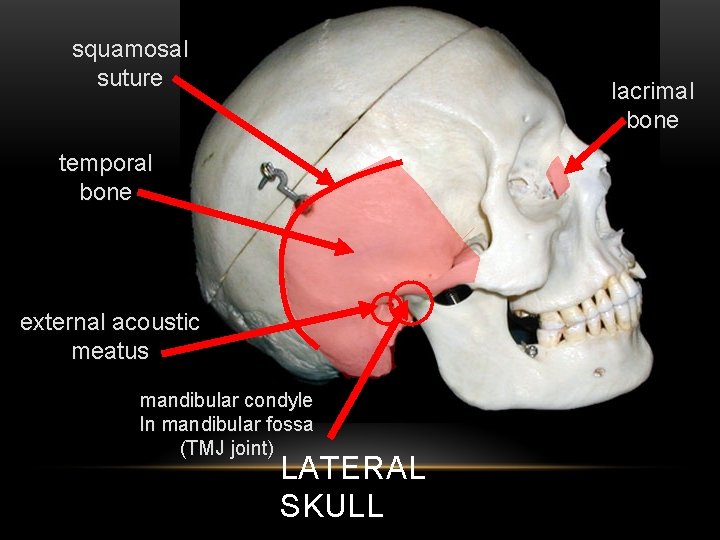 squamosal suture lacrimal bone temporal bone external acoustic meatus mandibular condyle In mandibular fossa