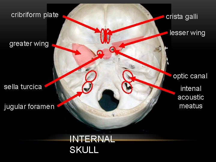 cribriform plate crista galli lesser wing greater wing optic canal sella turcica intenal acoustic
