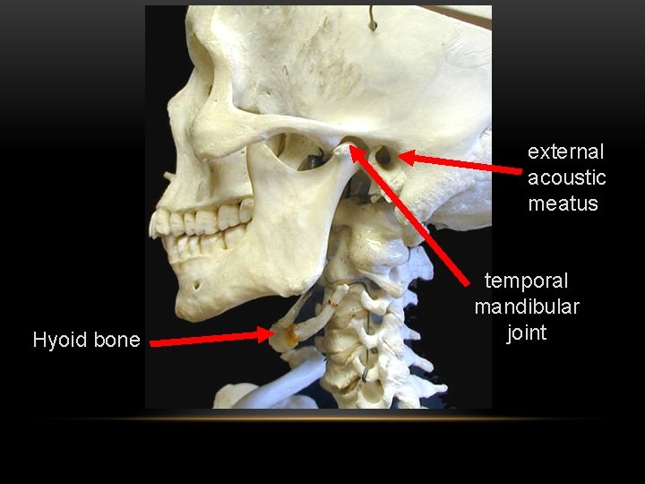 external acoustic meatus Hyoid bone temporal mandibular joint 