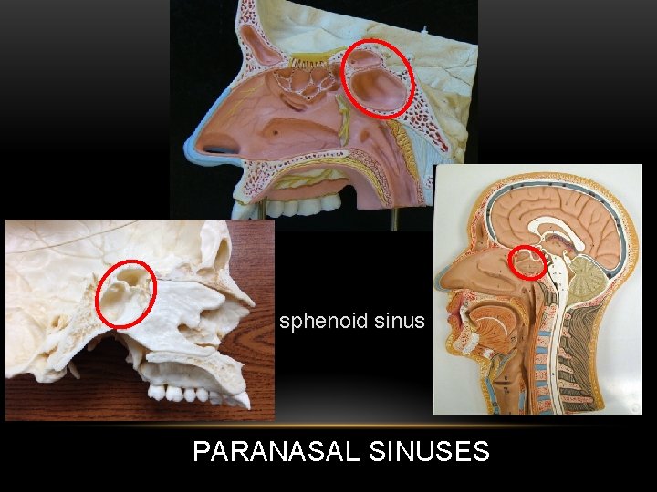 sphenoid sinus PARANASAL SINUSES 