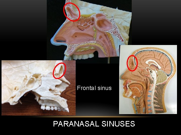 Frontal sinus PARANASAL SINUSES 