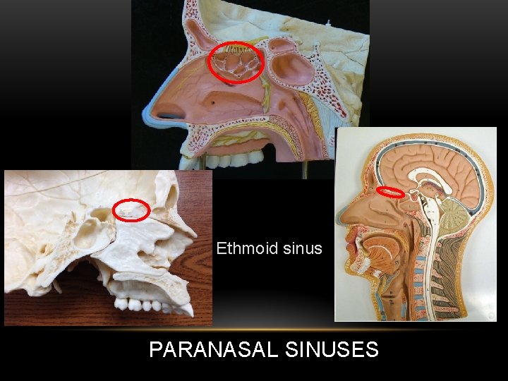 Ethmoid sinus PARANASAL SINUSES 