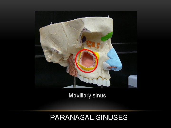 Maxillary sinus PARANASAL SINUSES 