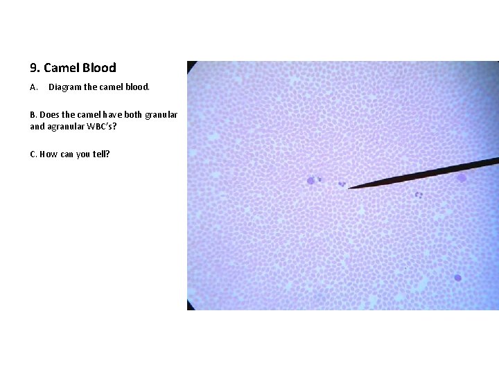 9. Camel Blood A. Diagram the camel blood. B. Does the camel have both