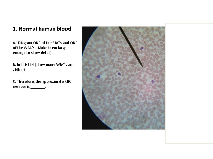 1. Normal human blood A. Diagram ONE of the RBC’s and ONE of the