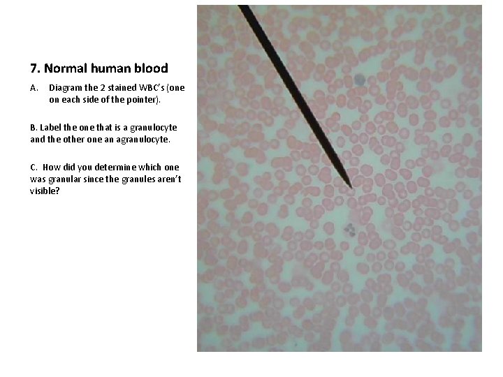 7. Normal human blood A. Diagram the 2 stained WBC’s (one on each side