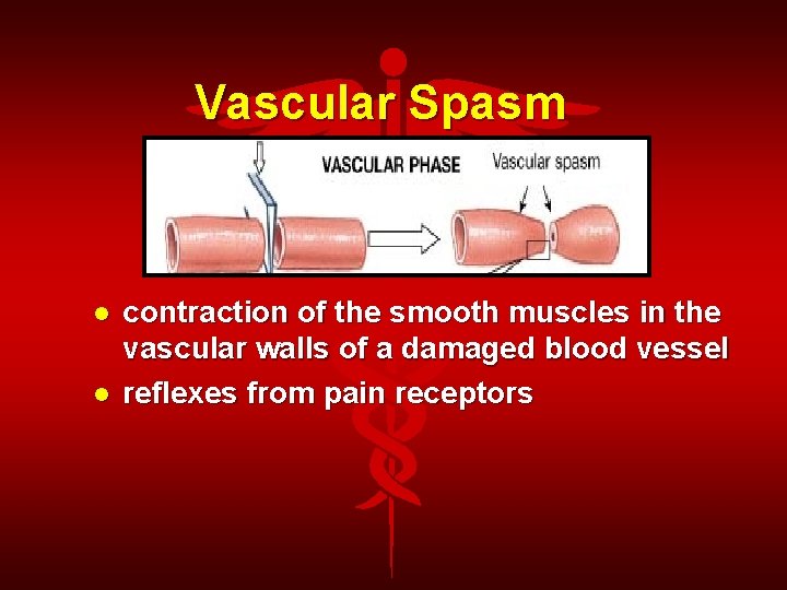Vascular Spasm contraction of the smooth muscles in the vascular walls of a damaged