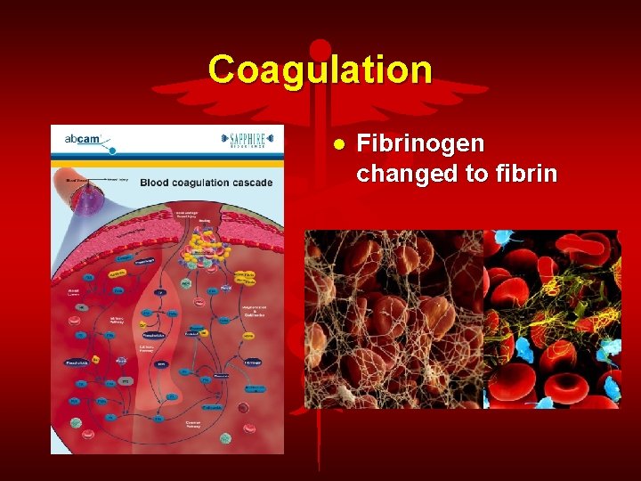 Coagulation Fibrinogen changed to fibrin 