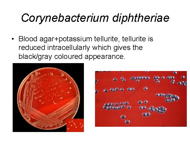 Corynebacterium diphtheriae • Blood agar+potassium tellurite, tellurite is reduced intracellularly which gives the black/gray