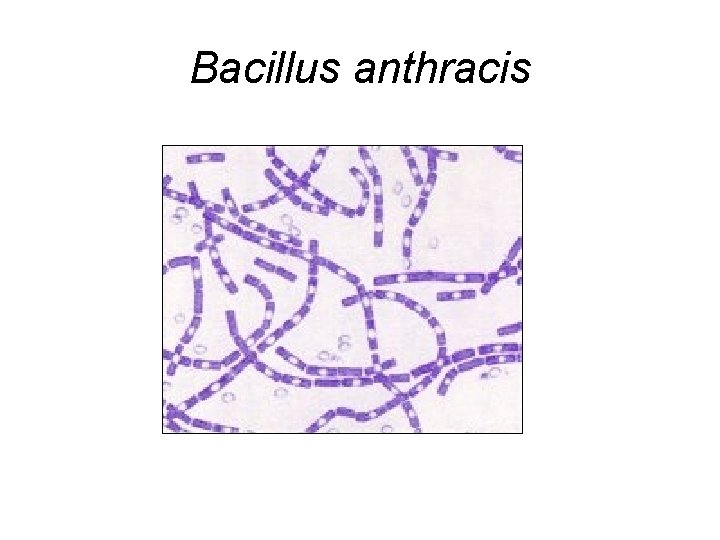 Bacillus anthracis 
