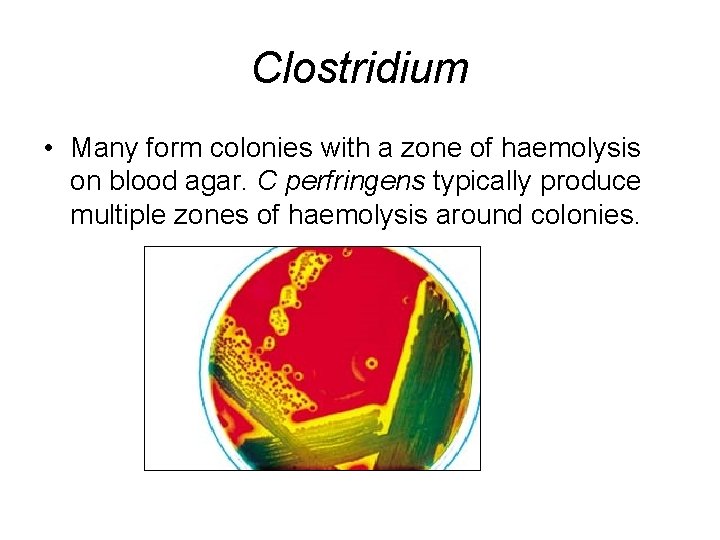 Clostridium • Many form colonies with a zone of haemolysis on blood agar. C