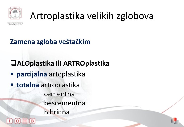 Artroplastika velikih zglobova Zamena zgloba veštačkim q. ALOplastika ili ARTROplastika § parcijalna artoplastika §