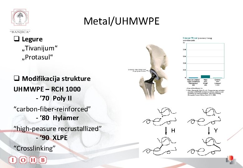 Metal/UHMWPE q Legure „Tivanijum“ „Protasul“ q Modifikacija strukture UHMWPE – RCH 1000 - ’