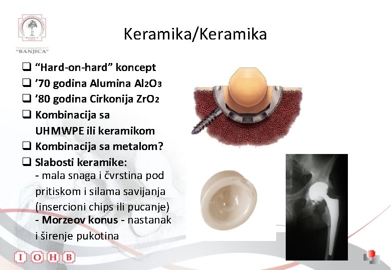 Keramika/Keramika q “Hard-on-hard” koncept q ’ 70 godina Alumina Al 2 O 3 q