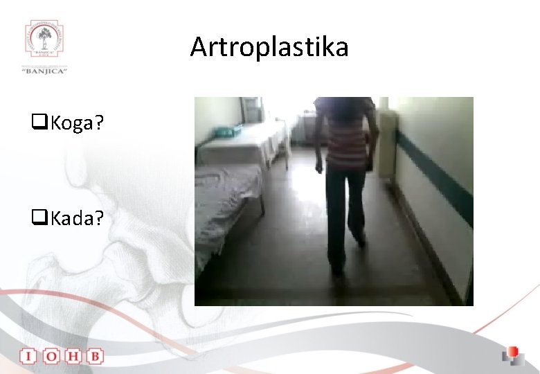 Artroplastika q. Koga? q. Kada? 