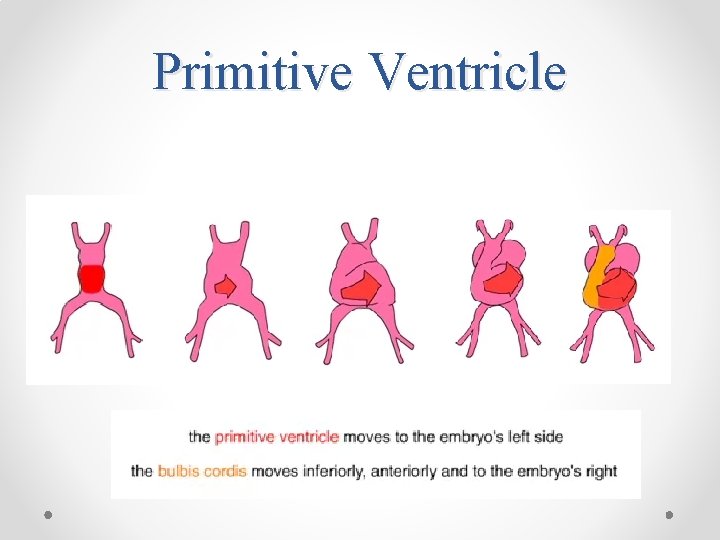 Primitive Ventricle 