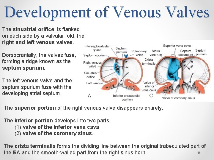 Development of Venous Valves The sinuatrial orifice, is flanked on each side by a